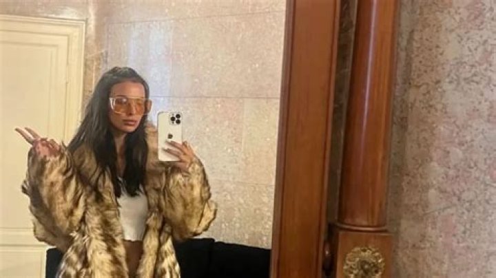 How Did Maya Jama Get A Scar On Her Shoulder?